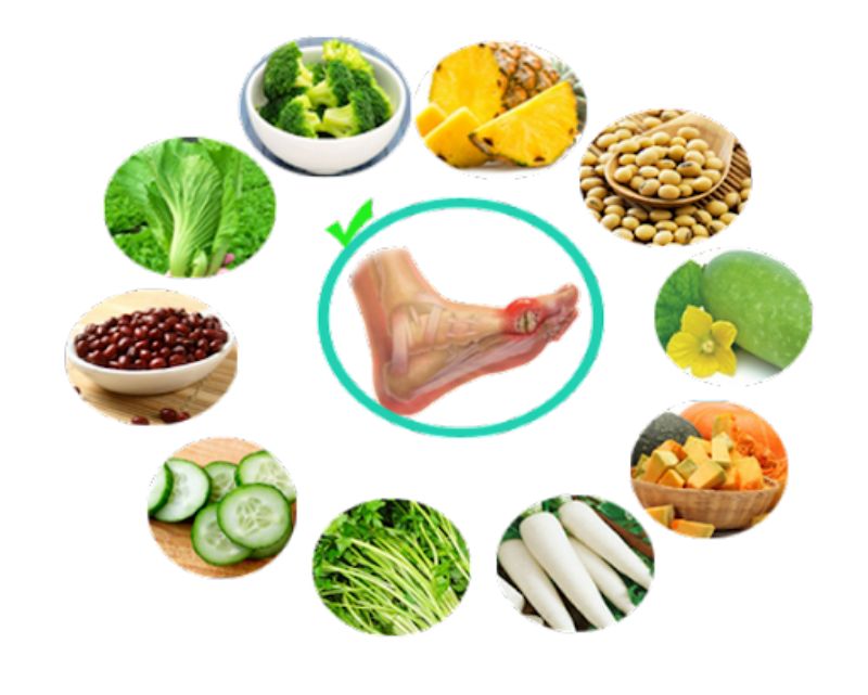 Ăn gì trị gout?